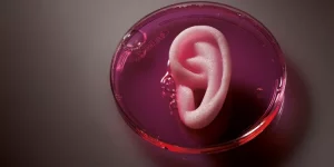 Лікарі вперше пересадили людині вухо з 3D-принтера