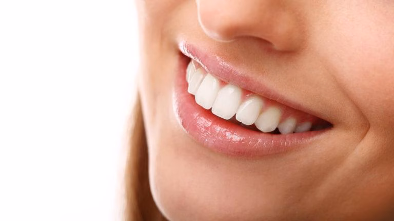 Стоматолог назвав продукти, що впливають на колір зубів