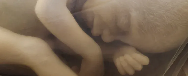 Вчені попереджають, що інфекція COVID-19 може викликати крововилив у мозок плода