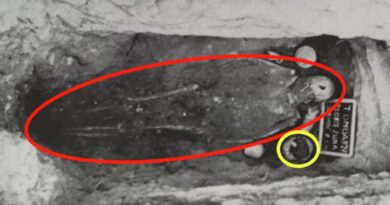 Дірка від цвяха в знайденому римському черепі могла бути застарілим заходом охорони здоров'я