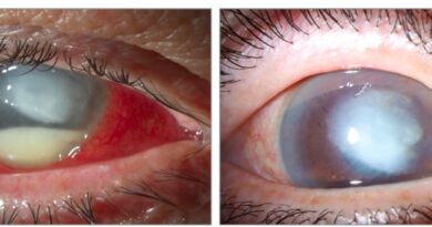 У США зростає кількість загиблих від очних крапель, заражених синьогнійною паличкою