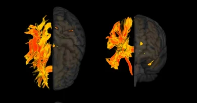 Деменція пов'язана з аномаліями мозку через високий кров'яний тиск