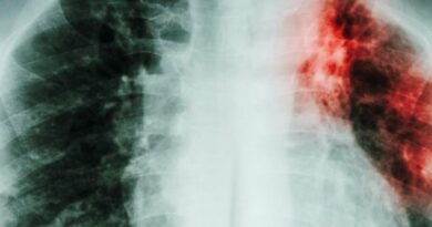 У Європі знову зростає смертність від туберкульозу