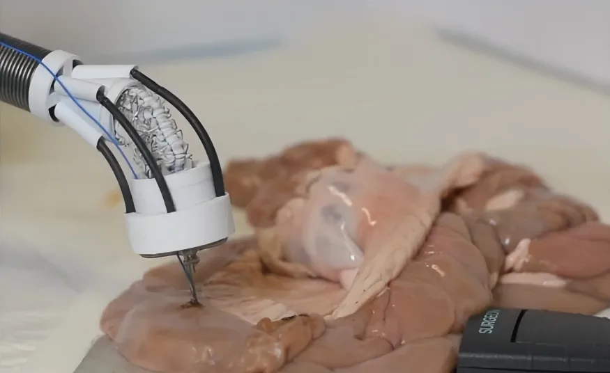 Новий 3D-біопринтер може відновити тканини зсередини, уникаючи серйозних операцій