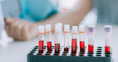 Проривний тест крові може вберегти тисячі пацієнтів від виснажливої хіміотерапії протягом року