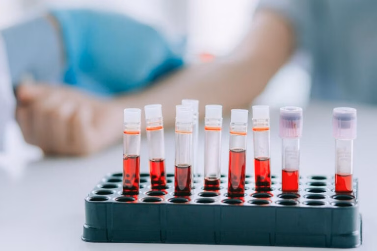 Проривний тест крові може вберегти тисячі пацієнтів від виснажливої хіміотерапії протягом року