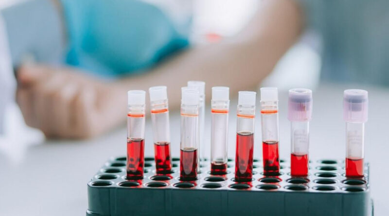 Проривний тест крові може вберегти тисячі пацієнтів від виснажливої хіміотерапії протягом року