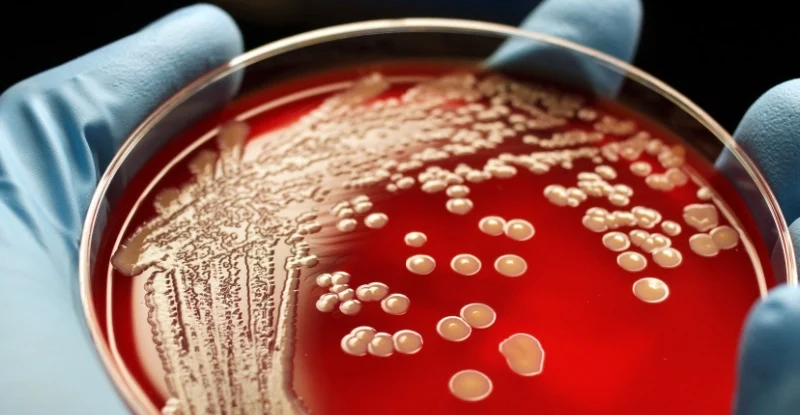 Вчені знайшли спосіб лікування стійких інфекцій без антибіотиків