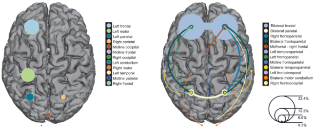 Ілюстрація, на якій зображено два мізки з різними кольорами для зображення цільових регіонів.
