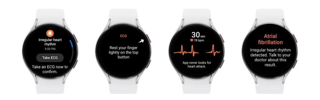 У серії Samsung Galaxy Watch 6 дебютує функція моніторингу серцевого ритму