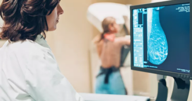 Жінкам слід починати робити регулярну мамографію у 40 років, рекомендує група експертів з питань охорони здоров'я США