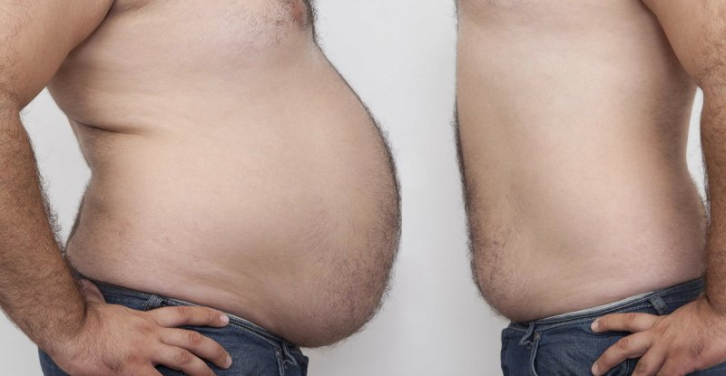 Інтервальне голодування проти рахування калорій: що ефективніше для схуднення?
