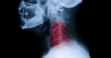 Експерти пояснили, чому потрібно припинити лікувати біль у спині опіоїдами
