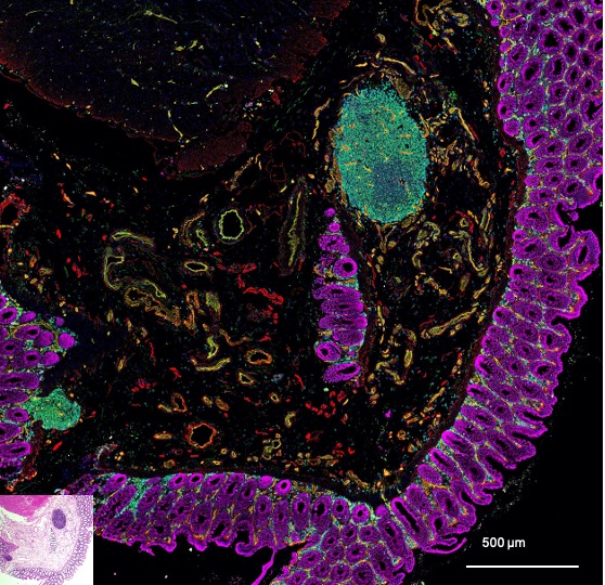 Флуоресцентне мікроскопічне зображення кишкової стінки зі вставкою типового гістологічного зрізу для порівняння.