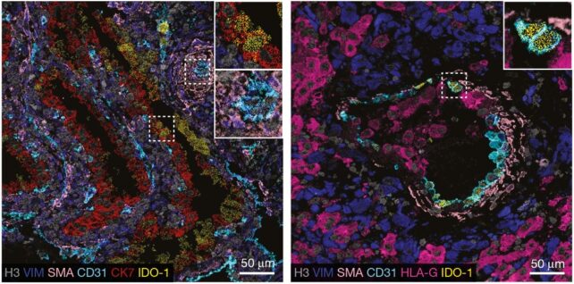 Два флуоресцентних мікроскопічних зображення клітин плаценти на 6 і 16 тижні.