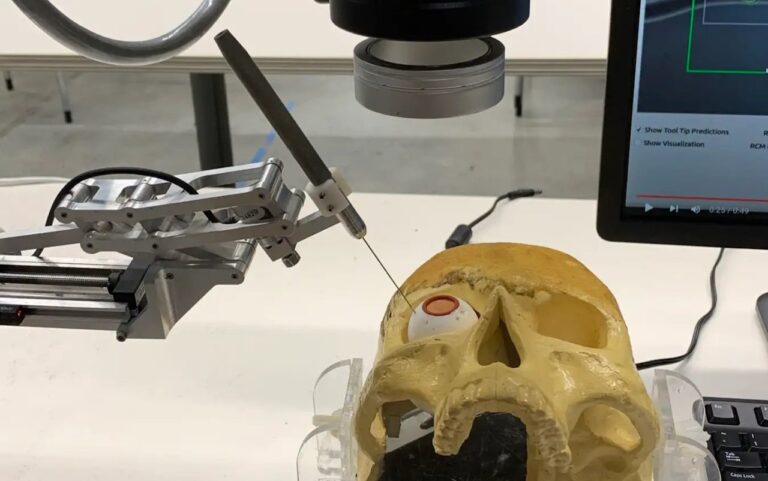 Роботизована рука зробила ін'єкцію в сітківку точніше за хірургів