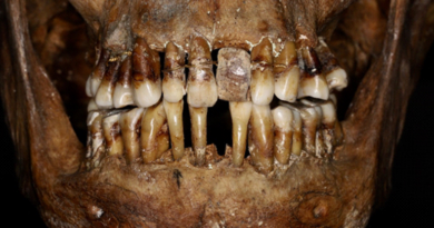 Секрет аристократки 17 століття: як вона зберігала свої зуби