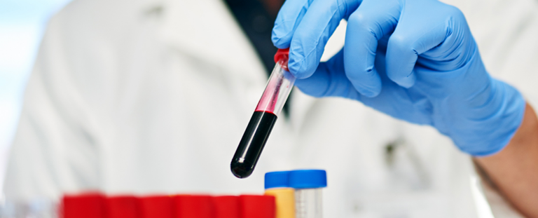 Прихований сигнал у вашій крові передбачає ризик деменції на десятиліття вперед