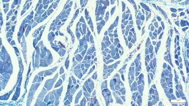 Клітини в поперечному розрізі серцевої тканини