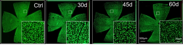 Чотири зображення клітин із збільшеними вставками, що показують зменшення кількості з часом.