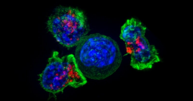 Вчені відкрили новий, несподіваний спосіб поширення ракових клітин