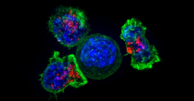 Вчені відкрили новий, несподіваний спосіб поширення ракових клітин