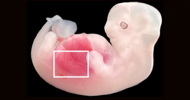 Вперше в світі: Нирки, вирощені з людських клітин у свинячих ембріонах