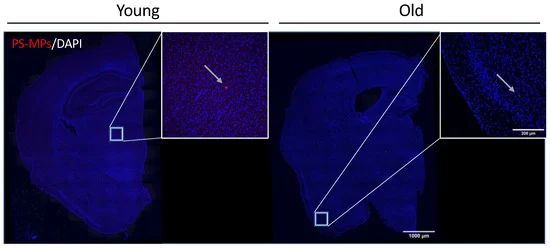 Накопичення мікропластику (червоних флуоресцентних точок) у мозку молодої та старої миші (Гаспар та ін., Міжнародний журнал молекулярної науки, 2023)