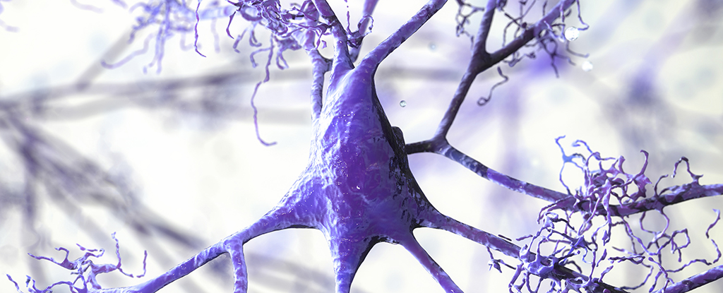 Абсолютно нову причину хвороби Альцгеймера виявлено у білій речовині нашого мозку
