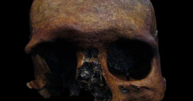 У черепі чоловіка, який жив 1600 років тому, виявили сліди менінгіоми