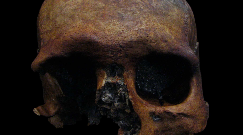 У черепі чоловіка, який жив 1600 років тому, виявили сліди менінгіоми
