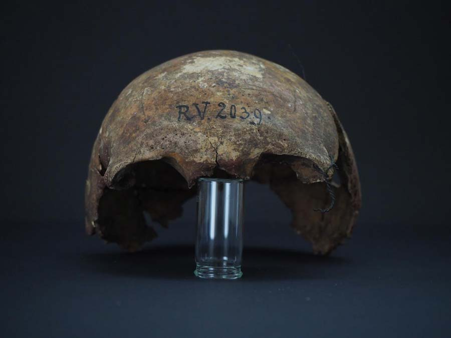 У черепі померлої 5000 років тому людини знайшли найдавніший зразок чумної палички