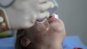 Людей із прищами вважають менш успішними і такими, що заслуговують на довіру