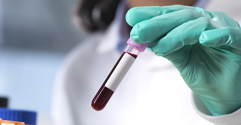 Аналіз крові може виявити хворобу Крона за 8 років до діагнозу