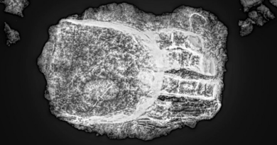 Загадкова штучна рука знайдена на скелеті, похованому в середньовіччі