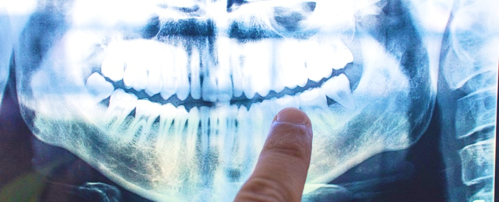 Причина хвороби Альцгеймера може критися у вашому роті