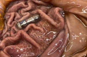 Інженери винайшли вібруючу "таблетку", що обманює шлунок