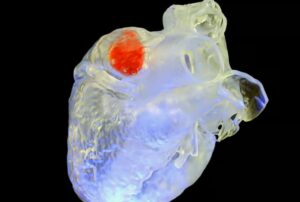 Революційна ультразвукова технологія дозволить друкувати імплантати прямо в тілі людини