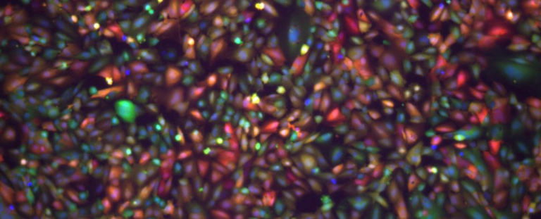 Вчені вважають, що вони на межі подолання гематоенцефалічного бар'єра