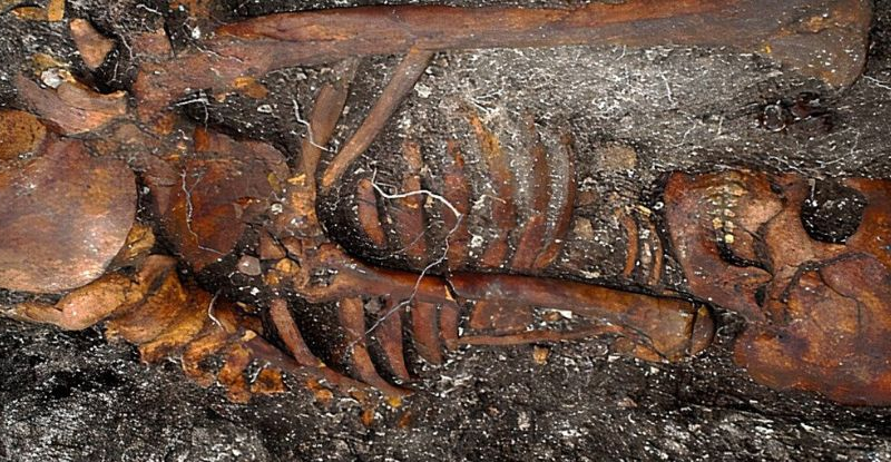 Знайдені кістки в Бразилії суперечать теорії про походження сифілісу в Європі від Колумба