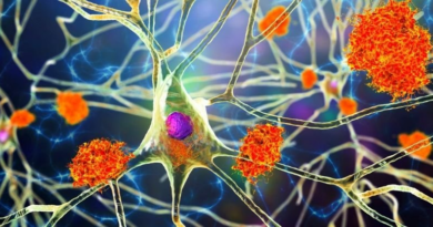 Вчені виявили зв'язок між вірусами та хворобою Альцгеймера