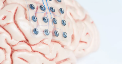 Перший у світі імплантат мозку для лікування епілепсії виявився життєво важливим