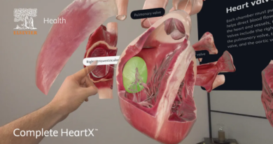 Модель серця на основі просторових обчислень висвітлює симптоми серцевого нападу у жінок