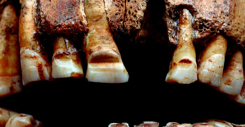 Вікінги використовували борозенки на зубах для ідентифікації, - дослідження