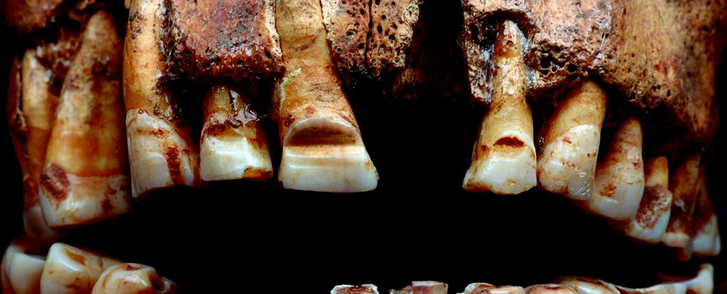 Вікінги використовували борозенки на зубах для ідентифікації, - дослідження