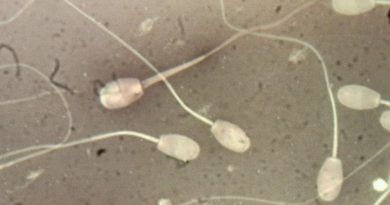 Вчені виявили мікропластик у чоловічій статевій системі