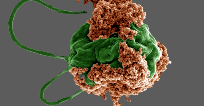 Крихітні мікророботи з водоростей можуть змінити лікування раку легенів