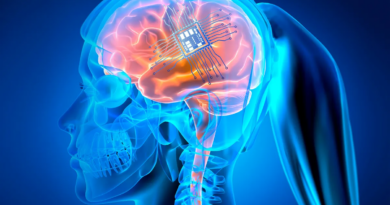 Побито світовий рекорд за кількістю електродів, розміщених на мозку людини