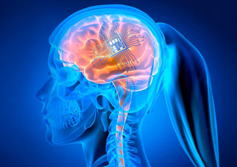 Побито світовий рекорд за кількістю електродів, розміщених на мозку людини