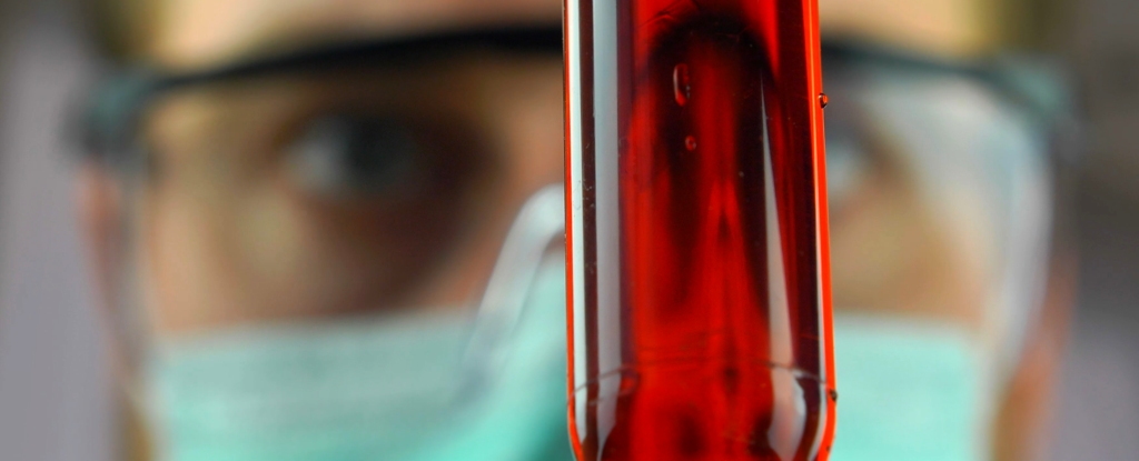 Новий аналіз крові може допомогти розгадати таємницю розсіяного склерозу